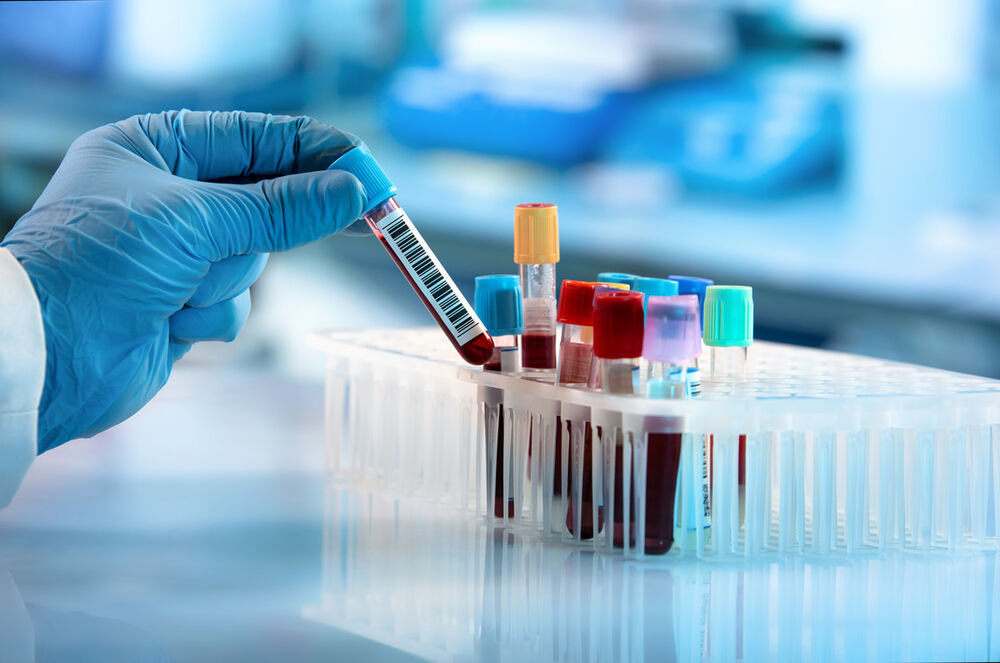 The Essential Lab Tests Every Primary Care Patient Should Know