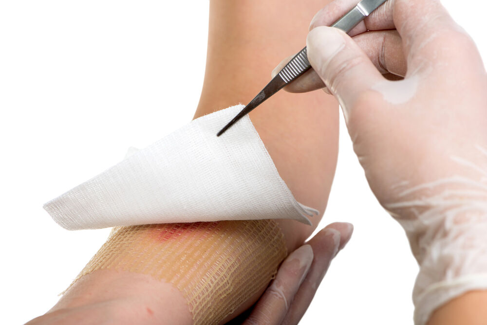 Understanding Chronic Wounds: Why Some Wounds Don’t Heal & What We Can Do